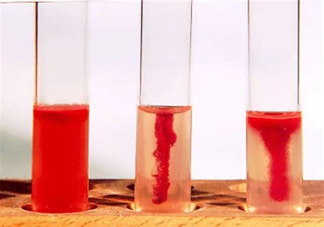 test tube with soft agar purpose|Motility Tests for Bacteria: Principles, Procedures And Results.